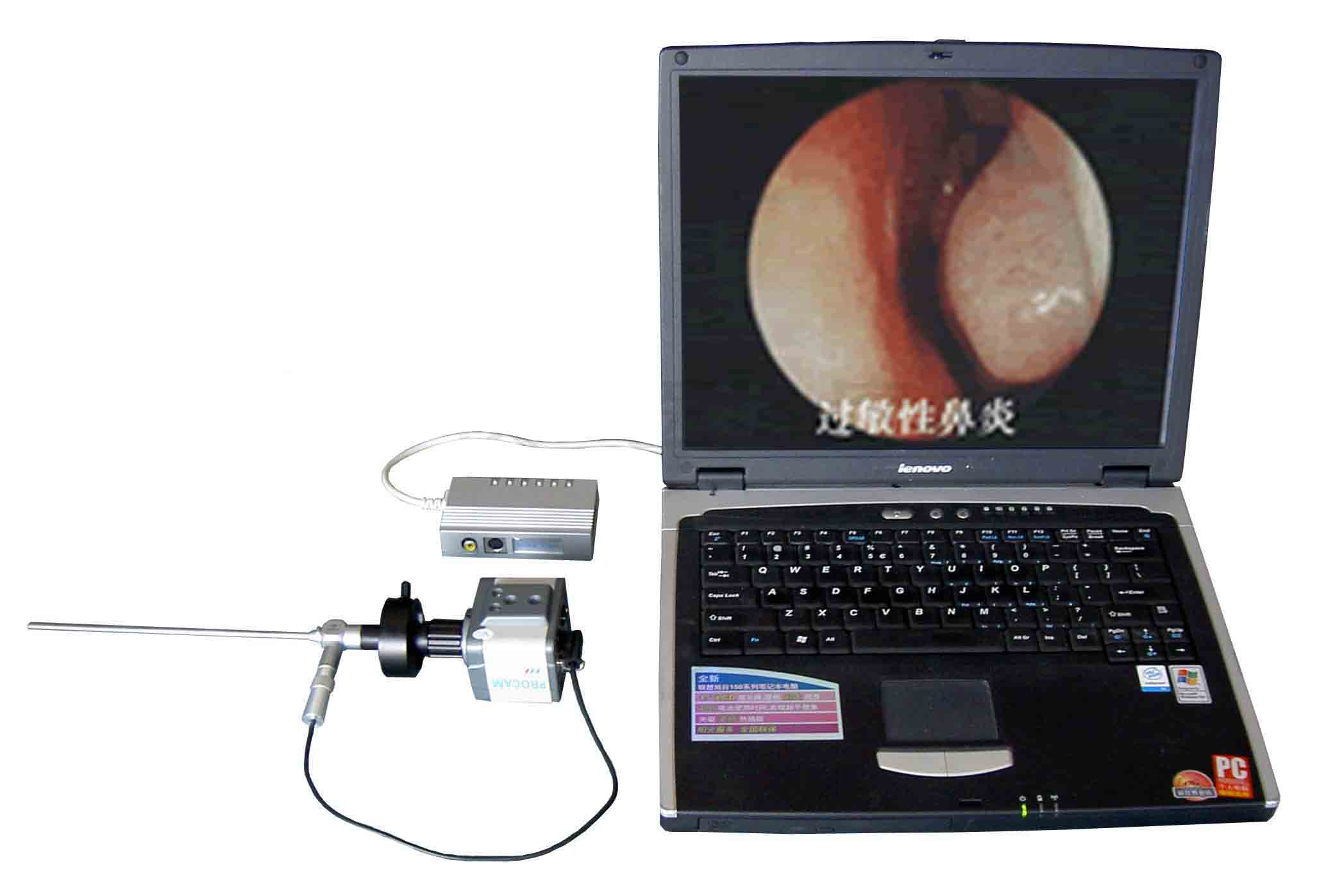 数码电子鼻窦镜（便携式）